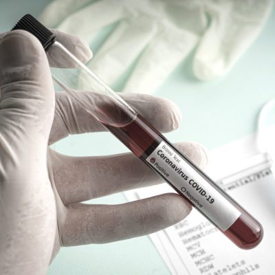 118 new cases of coronavirus in Samtskhe-Javakheti