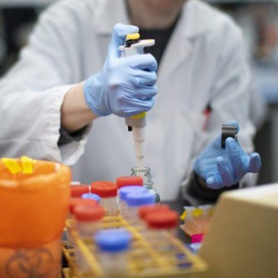 საქართველოში კორონავირუსით ინფიცირების 20 326 ახალი შემთხვევა დაფიქსირდა, აქედან სამცხე-ჯავახეთში – 307