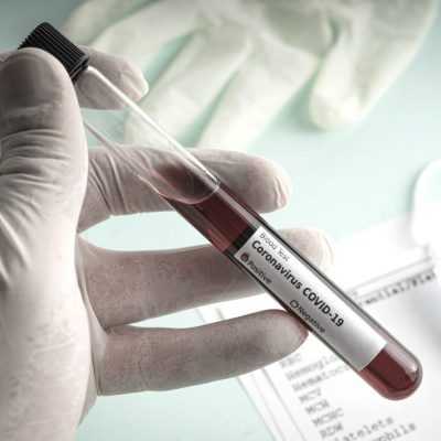 Coronavirus in Georgia: statistics April 4